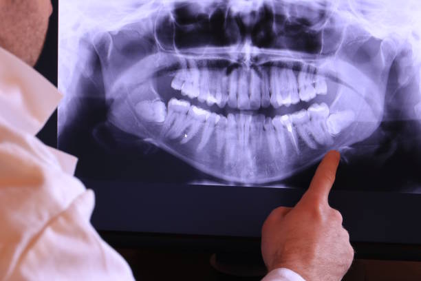 Best Emergency Tooth Extraction in Pine Brook, NJ